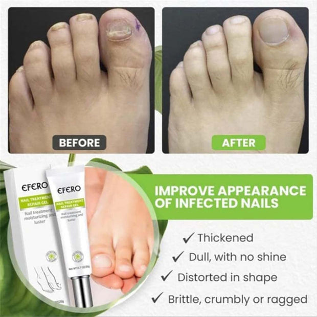 EFERO Nail Treatment Repair Gel