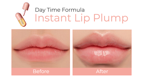 Derol Lip Plumper Kit